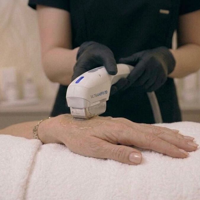 Rejuvenecimiento de manos 2